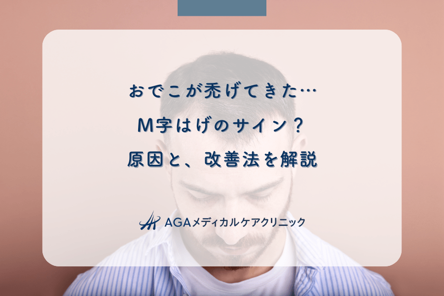 おでこが禿げてきた…M字はげのサイン？原因と、改善法を解説
