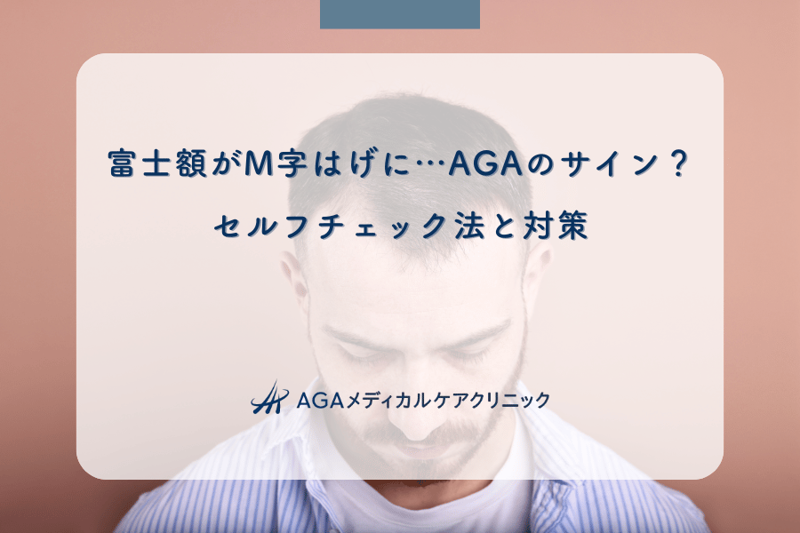 富士額がM字はげに…AGAのサイン？セルフチェック法と対策