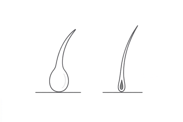 正常な抜け毛の毛根形状と注意すべき毛根の違い｜セルフチェックの視覚ガイド