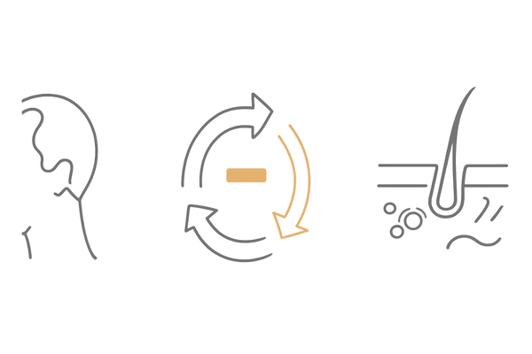 髪が減る主な原因(AGA・ヘアサイクル乱れ・頭皮環境)を直感的に示す3カラムアイコン図