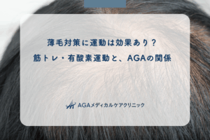 薄毛対策に運動は効果あり？筋トレ・有酸素運動と、AGAの関係