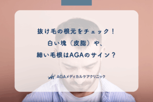 抜け毛の根元をチェック！白い塊（皮脂）や、細い毛根はAGAのサイン？