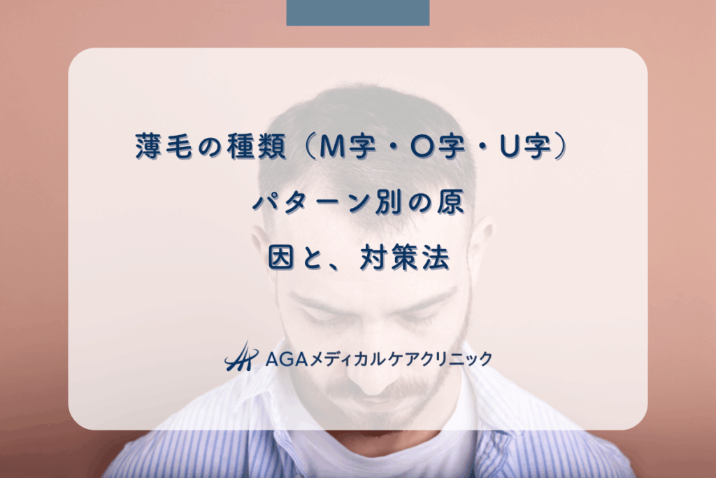 薄毛の種類（M字・O字・U字）｜パターン別の原因と、対策法