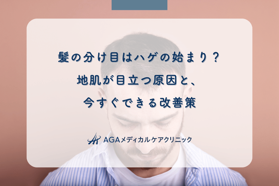 髪の分け目はハゲの始まり？地肌が目立つ原因と、今すぐできる改善策