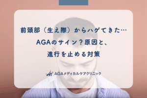 前頭部（生え際）からハゲてきた…AGAのサイン？原因と、進行を止める対策