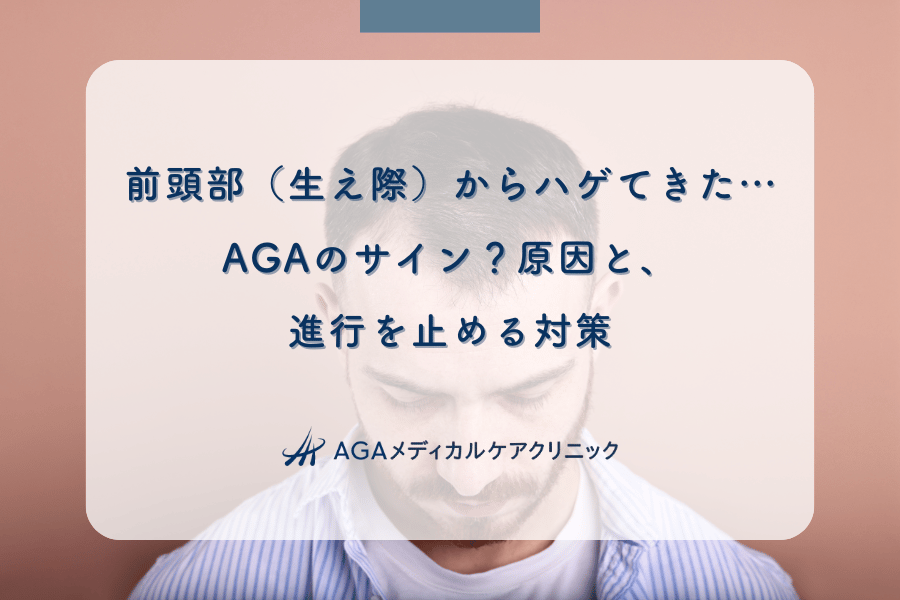 前頭部(生え際)からハゲてきた…AGAのサイン?原因と、進行を止める対策