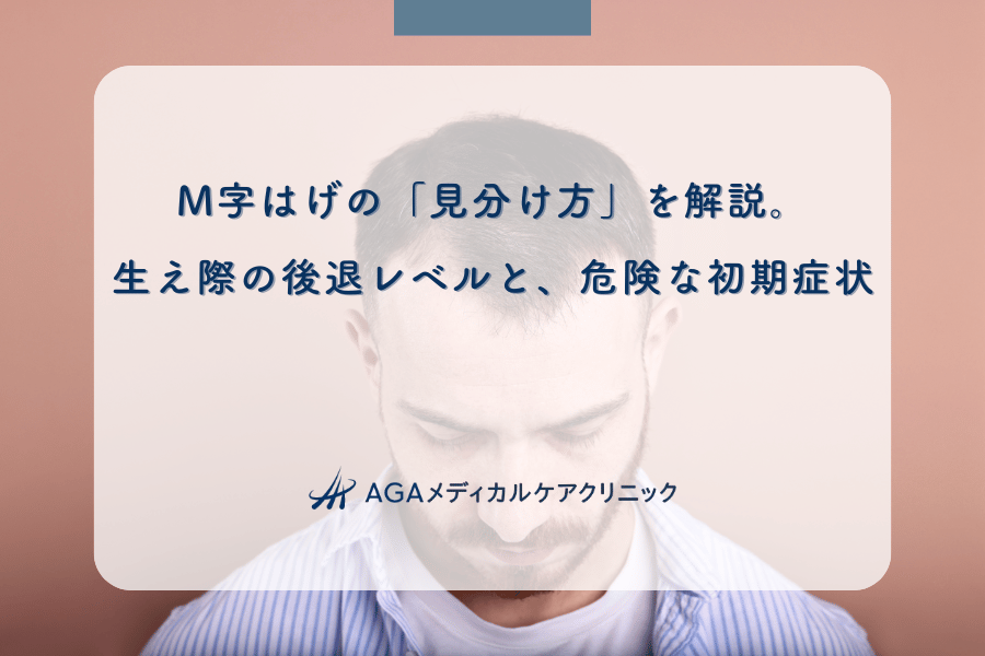 M字はげの「見分け方」を解説。生え際の後退レベルと、危険な初期症状