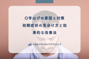 O字はげの原因と対策｜初期症状の見分け方と効果的な改善法