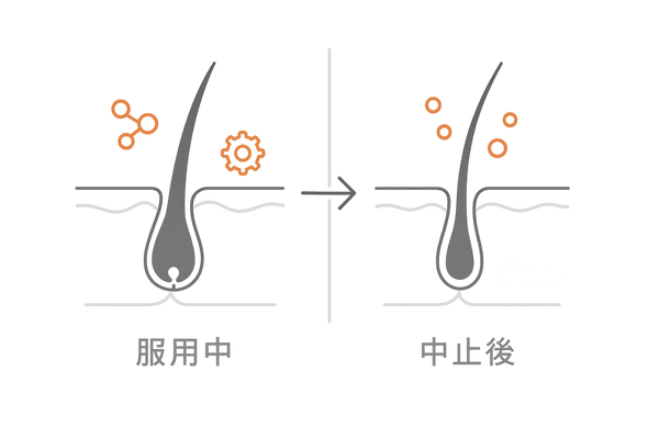 プロペシア中止による体内変化と毛包への影響（DHT再増加のイメージ図・比較）