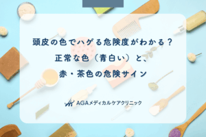 頭皮の色でハゲる危険度がわかる？正常な色（青白い）と、赤・茶色の危険サイン