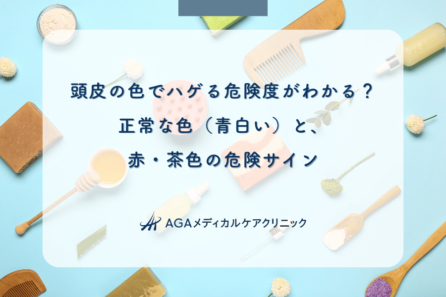 頭皮の色でハゲる危険度がわかる？正常な色（青白い）と、赤・茶色の危険サイン