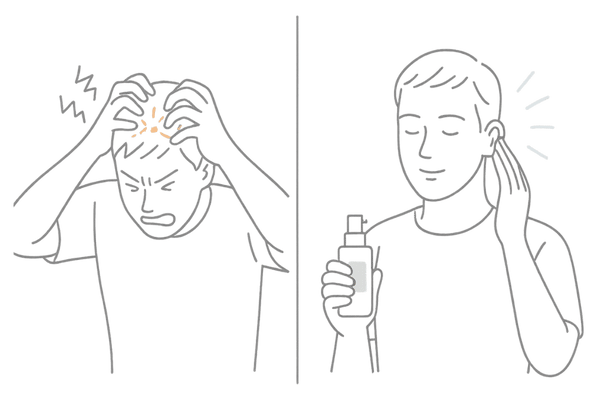 頭皮を掻きむしるNG行為と優しいケアの対比イメージ