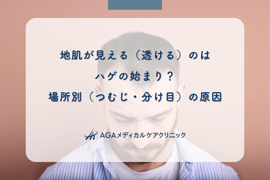地肌が見える（透ける）のはハゲの始まり？場所別（つむじ・分け目）の原因