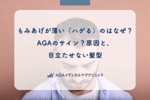 もみあげが薄い（ハゲる）のはなぜ？AGAのサイン？原因と、目立たせない髪型