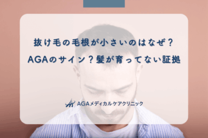 抜け毛の毛根が小さいのはなぜ？AGAのサイン？髪が育ってない証拠