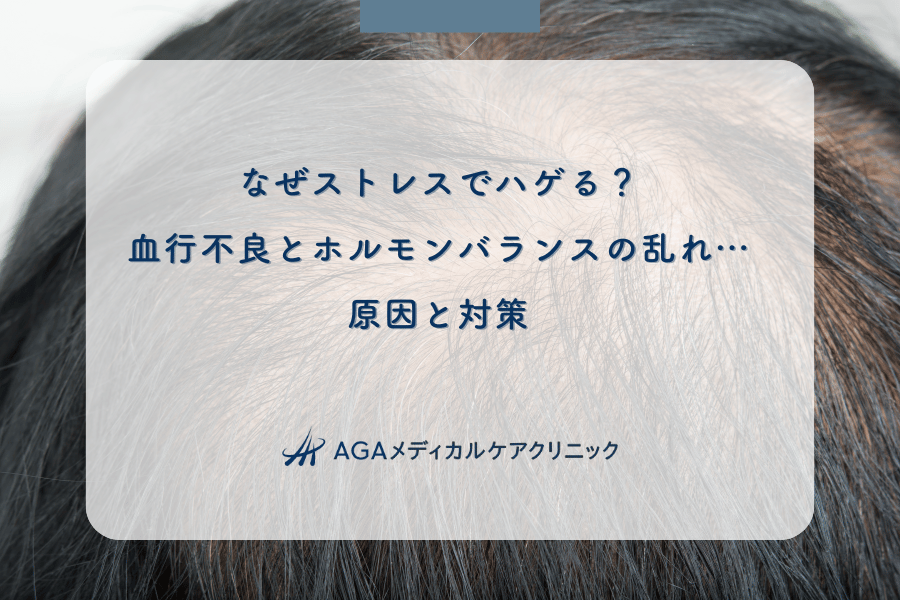 なぜストレスでハゲる？血行不良とホルモンバランスの乱れ…原因と対策