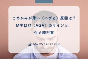 こめかみが薄い（ハゲる）原因は？M字はげ（AGA）のサインと、生え際対策