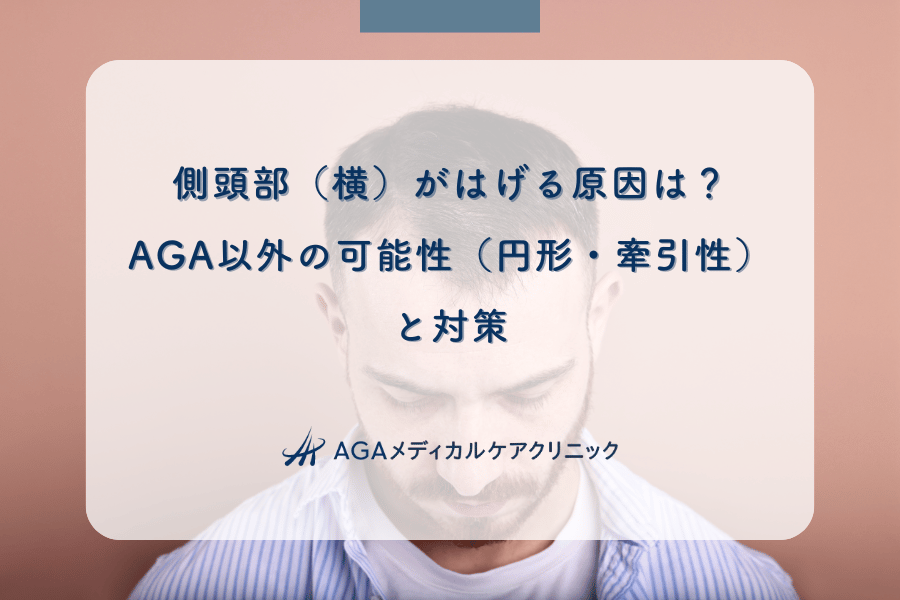 側頭部（横）がはげる原因は？AGA以外の可能性（円形・牽引性）と対策