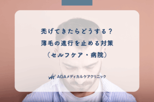 禿げてきたらどうする？薄毛の進行を止める対策（セルフケア・病院）