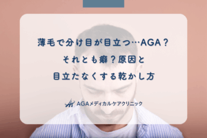 薄毛で分け目が目立つ…AGA？それとも癖？原因と目立たなくする乾かし方