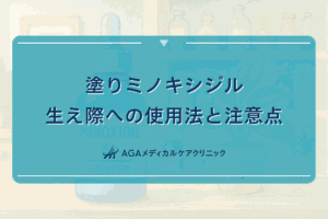 塗りミノキシジルの生え際への使用法と注意点