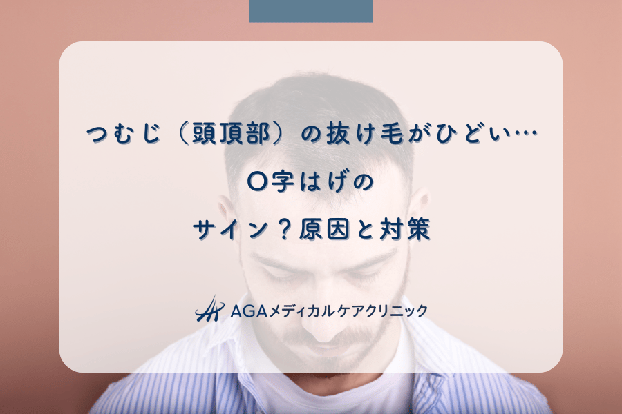つむじ(頭頂部)の抜け毛がひどい…O字はげのサイン?原因と対策