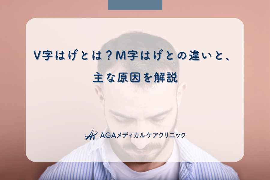 V字はげとは？M字はげとの違いと、主な原因を解説