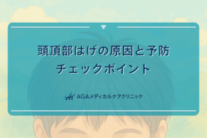 頭頂部はげの原因と予防｜早期発見のためのチェックポイント