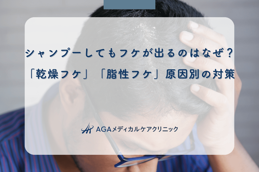 シャンプーしてもフケが出るのはなぜ？「乾燥フケ」「脂性フケ」原因別の対策