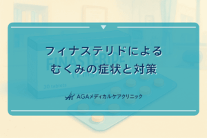 フィナステリドによるむくみの症状と対策