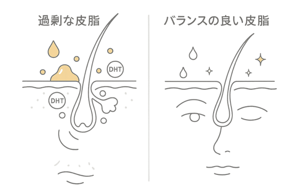 フィナステリドと頭皮・顔の皮脂分泌バランス図