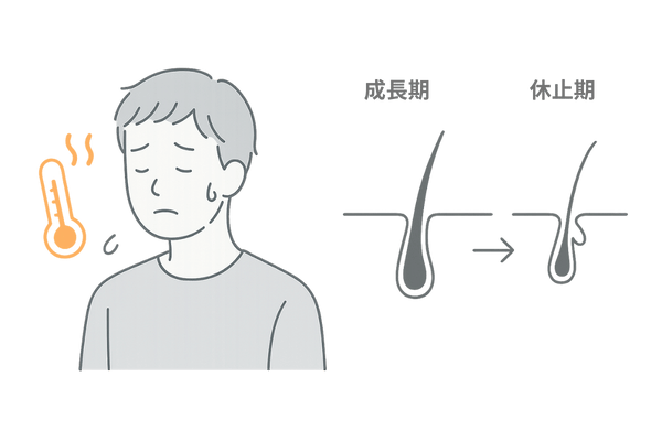 インフルエンザ後の高熱と休止期脱毛症の仕組みイメージ図