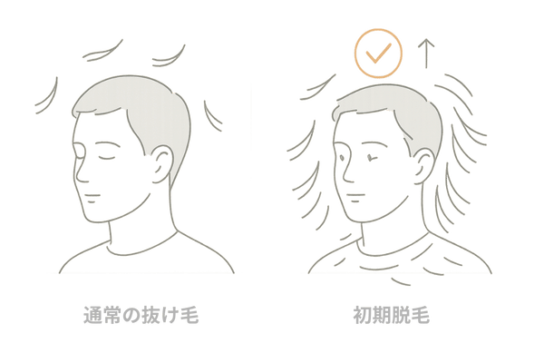 通常の抜け毛と育毛剤による初期脱毛の違いを比較したイラスト