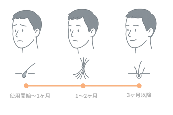 育毛剤による初期脱毛の期間と経過を示すタイムラインイメージ