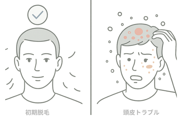 育毛剤の初期脱毛と頭皮トラブルによる脱毛の違いを示す比較イラスト