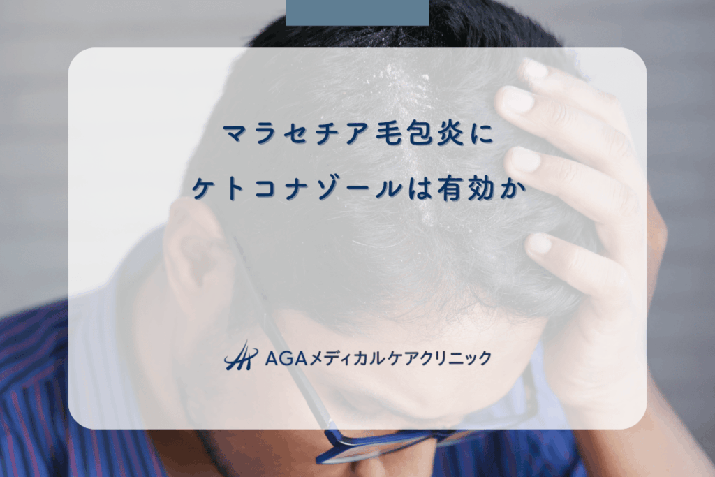 マラセチア毛包炎にケトコナゾールは有効か｜治療の実際