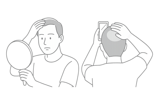 AGAセルフチェック(生え際と頭頂部を確認する男性のイメージイラスト)