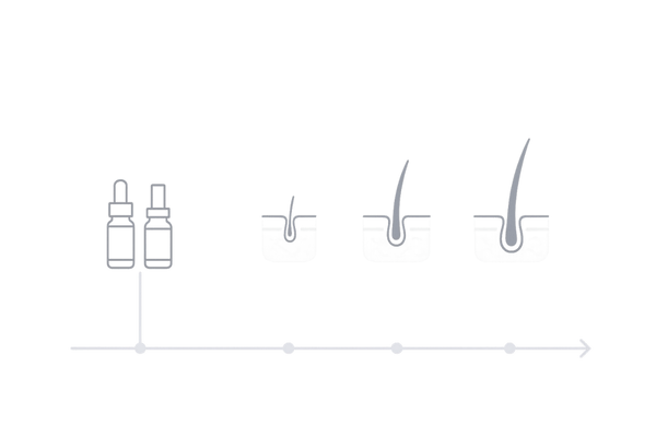 ミノキシジル5％の効果とヘアサイクルの変化を示すタイムラインイメージ