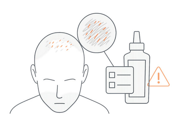 ミノキシジル外用薬の安全な使い方と副作用リスクを意識したイメージ図