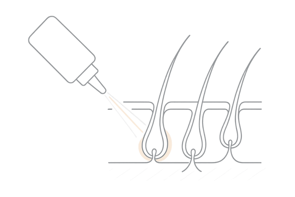 ミノキジェットの仕組みを頭皮断面図で示したAGA治療イラスト