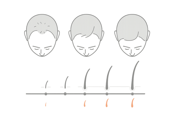 ミノキシジル1%の発毛効果が現れるまでの6か月タイムラインイメージ