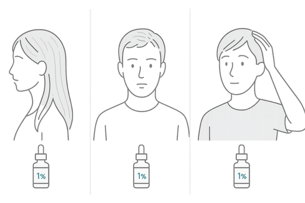 ミノキシジル1%が向いている人のタイプ別イメージ(女性・初期AGA・敏感肌)