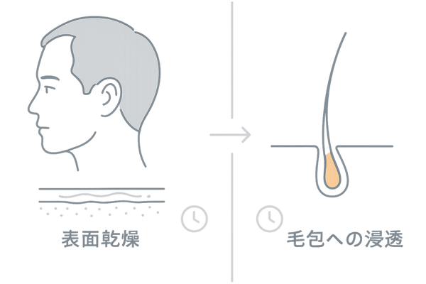 ミノキシジルの表面乾燥と毛包への浸透時間の違いを示すイラスト