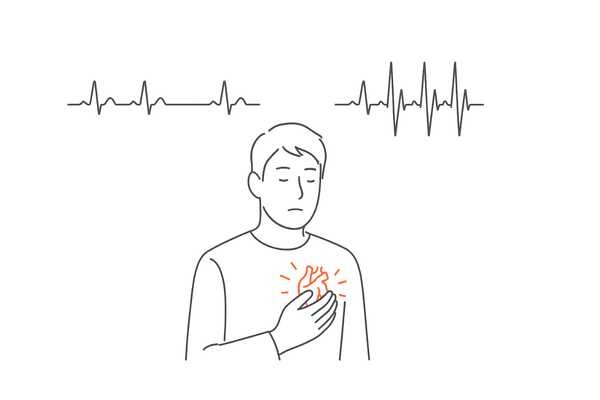 ミノキシジル使用時の反射性頻脈と動悸・息切れを表現したイメージ図
