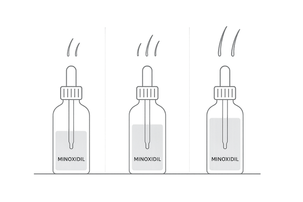 ミノキシジル1%・3%・5%濃度の違いと位置づけをイメージで比較した図