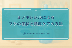 ミノキシジルによるフケの症状と頭皮ケアの方法