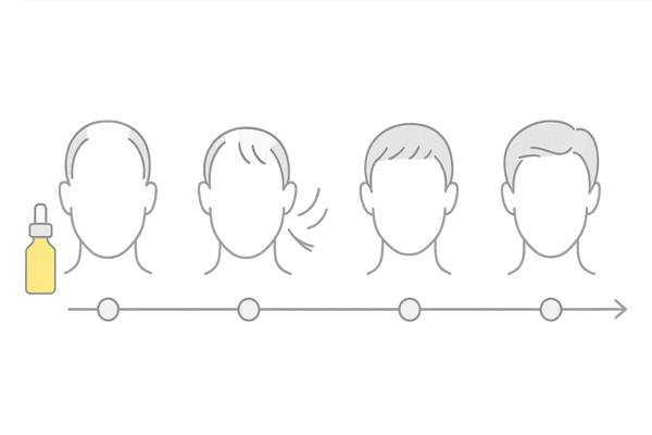 ミノキシジル外用薬の使用から初期脱毛・効果実感までの経過イメージ