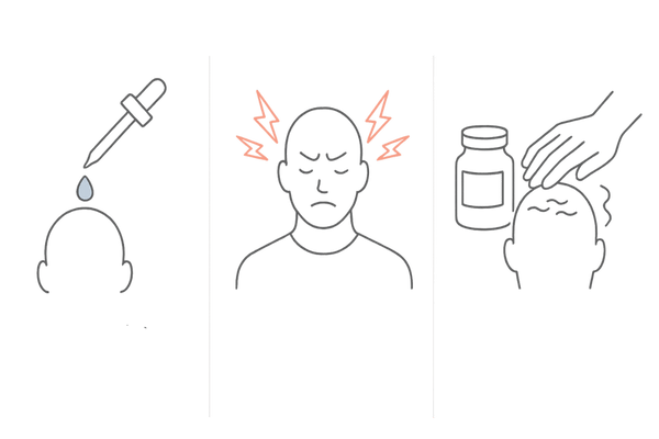 ミノキシジルで肌荒れが起こる主な原因のイラスト図解