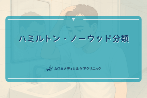 ハミルトン・ノーウッド分類による薄毛の診断