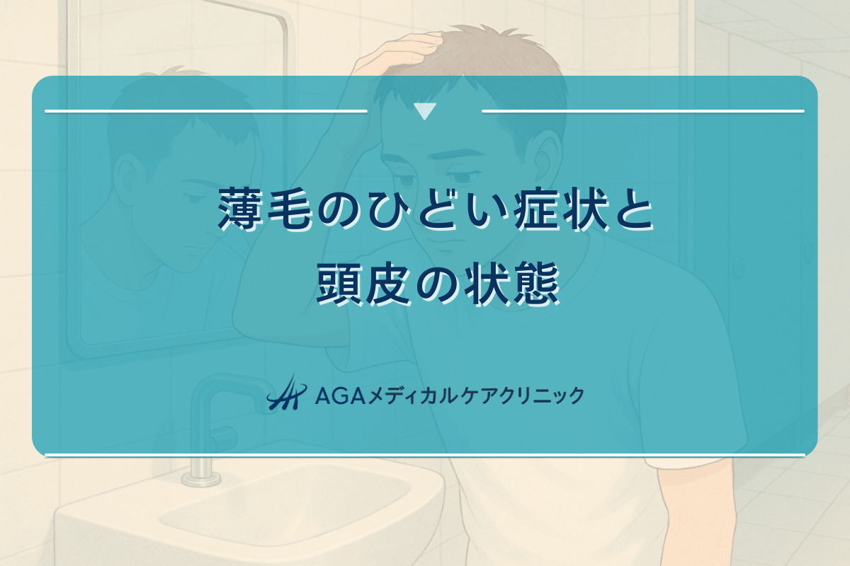 薄毛のひどい症状と頭皮の状態｜段階的な対処法